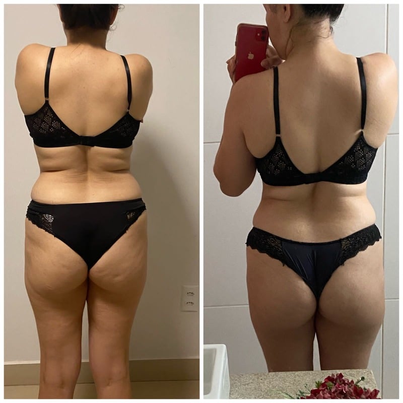 Antes e Depois — Aluna 4