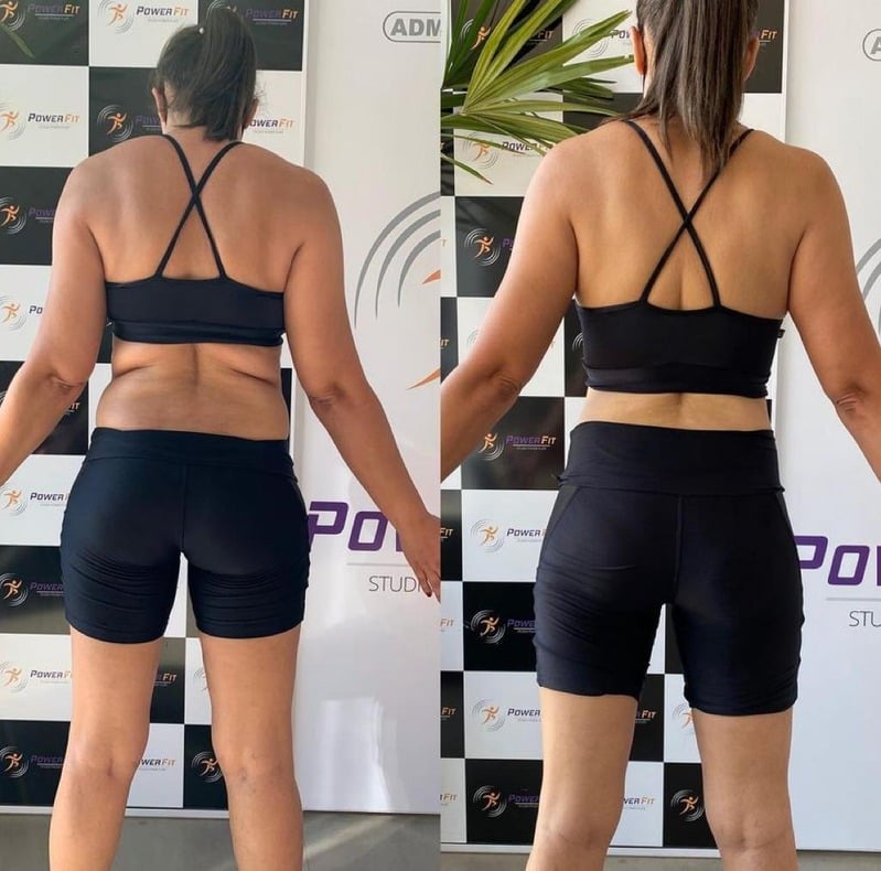 Antes e Depois — Aluna 5